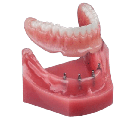 Dentaduras en Lake City, FL Opciones de Dentadura Aspire Dental Group 2